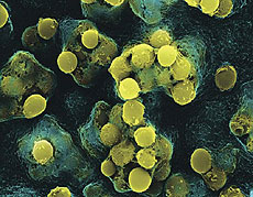 Streptococcus Pyogenes